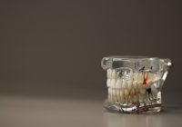 Photo Flexible dental prosthesis