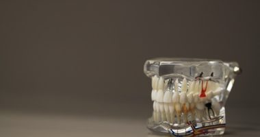 Photo Flexible dental prosthesis